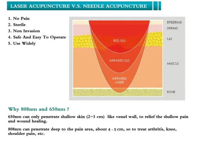 LASER ACUPUNCTURE V.S. NEEDLE ACUPUNCTURE